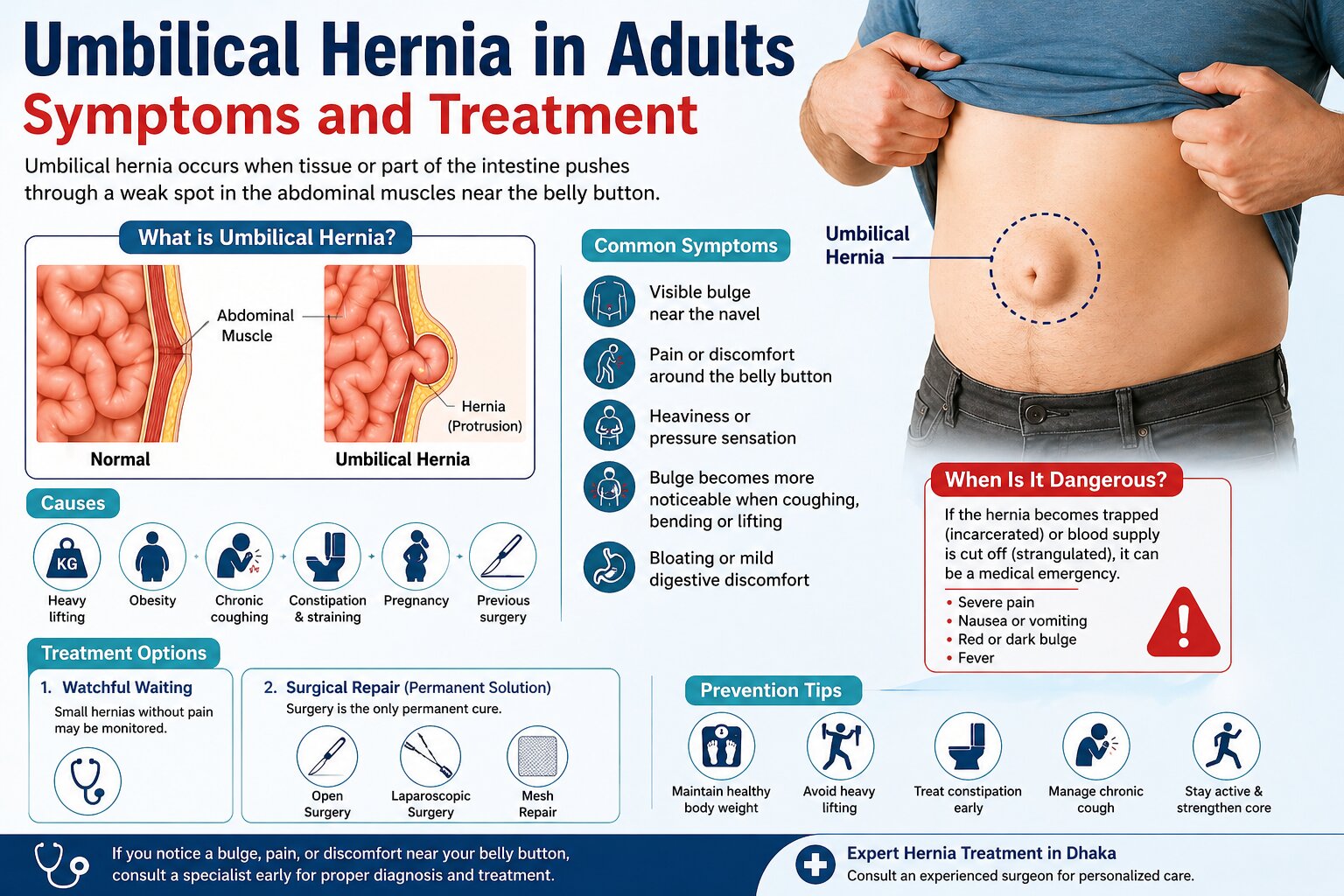 Umbilical Hernia in Adults – Symptoms and Treatment